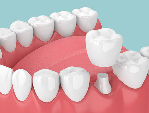 Ideal Dental Care