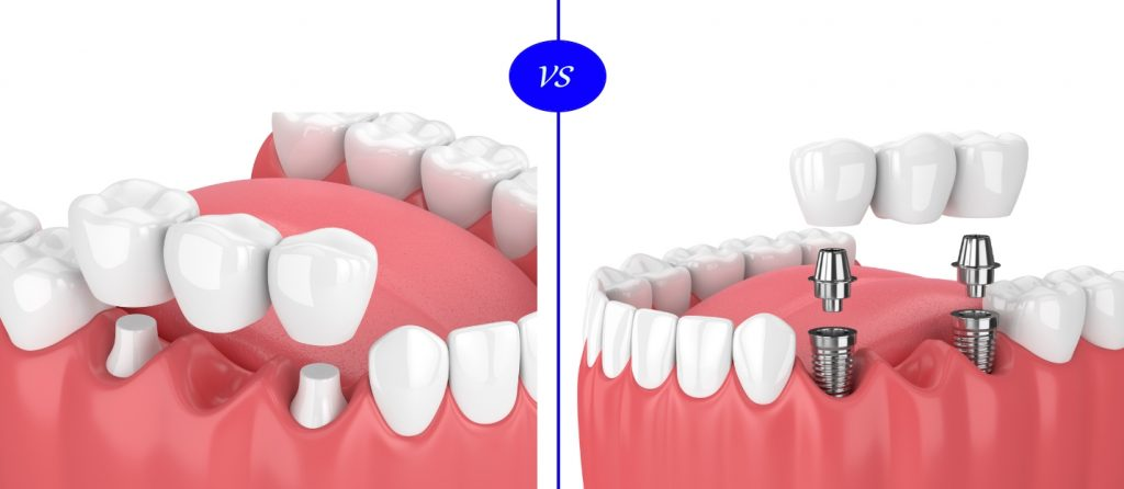 Ideal Dental Care