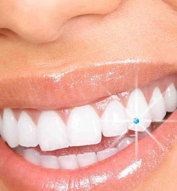 Tooth Jewellery