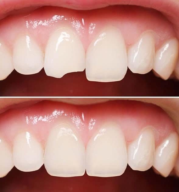 Cosmetic Dentistry Indore