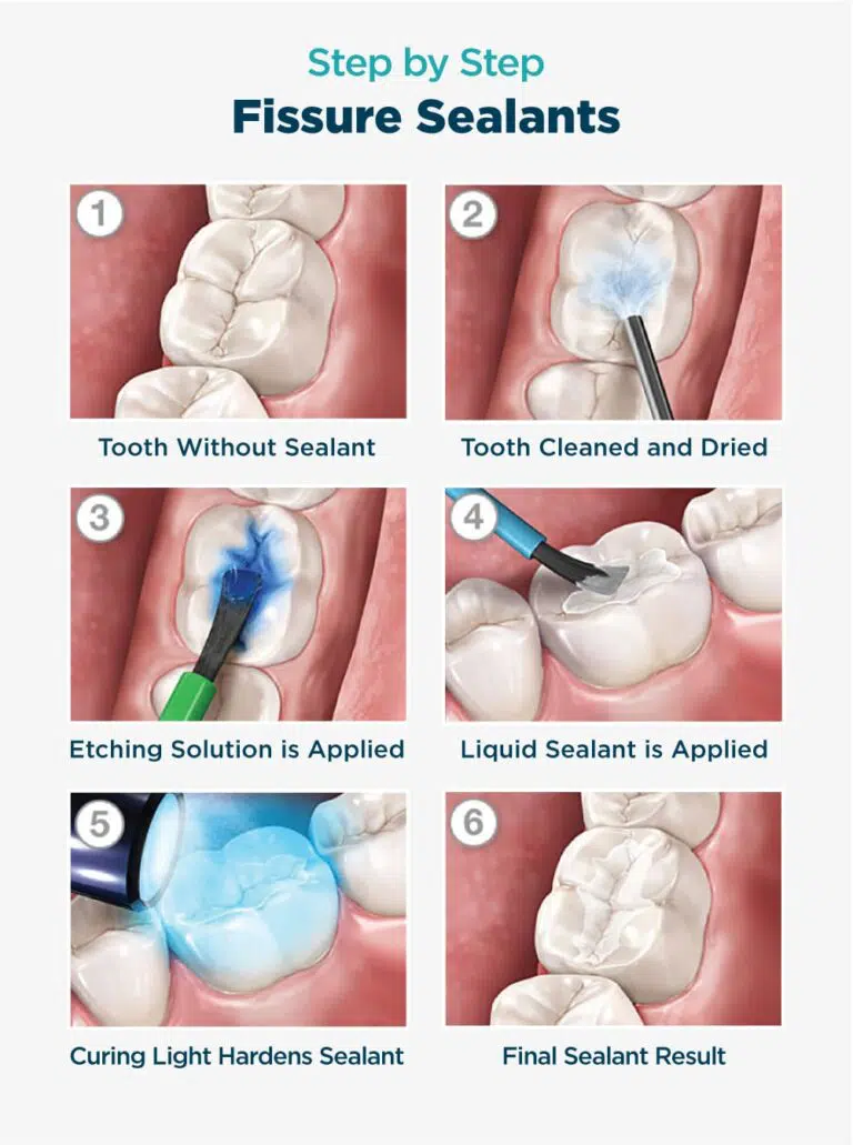 Ideal Dental Care