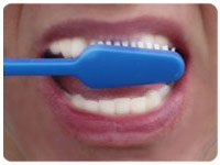Ideal Dental Care