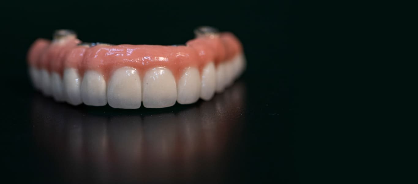 Precision full-mouth dental restoration