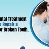 5-Best-Dental-Treatment-Options-to-Repair-a-Chipped-or-Broken-Tooth