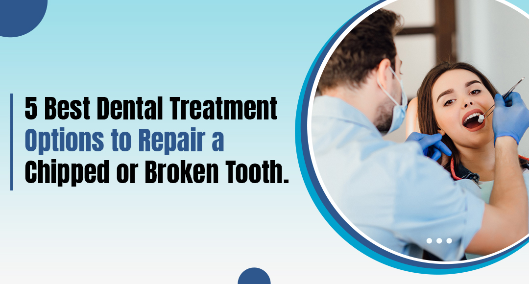 5 Best Dental Treatment Options to Repair a Chipped or Broken Tooth 