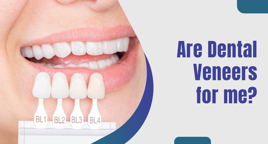 Are Dental Veneers for me?