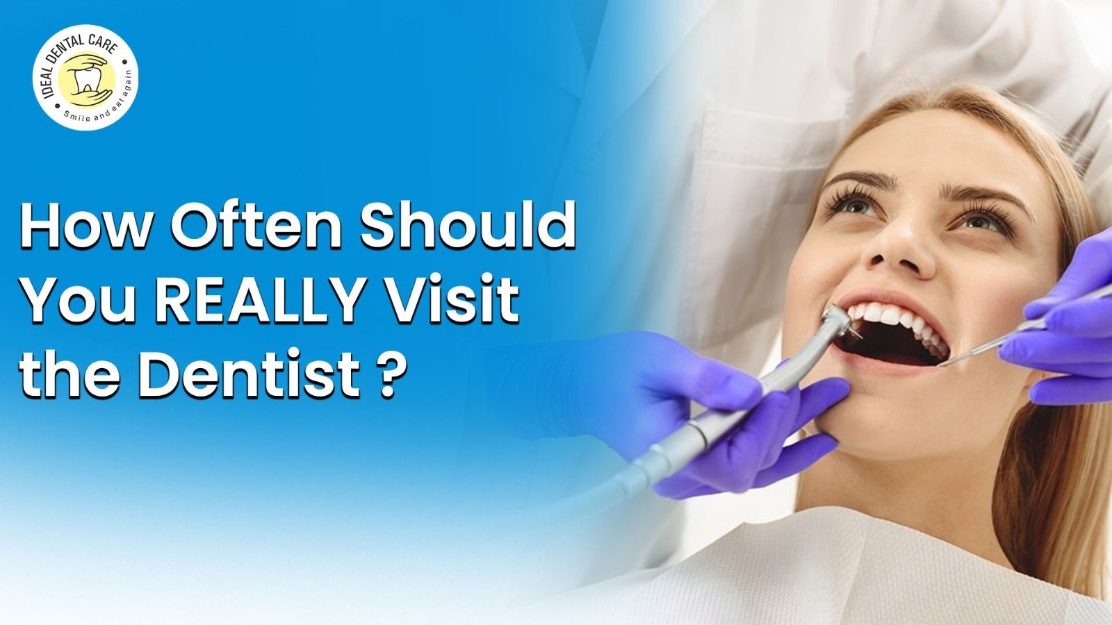 How Often Should You Visit the Dentist? Tips from Ideal Dental Care, Indore
